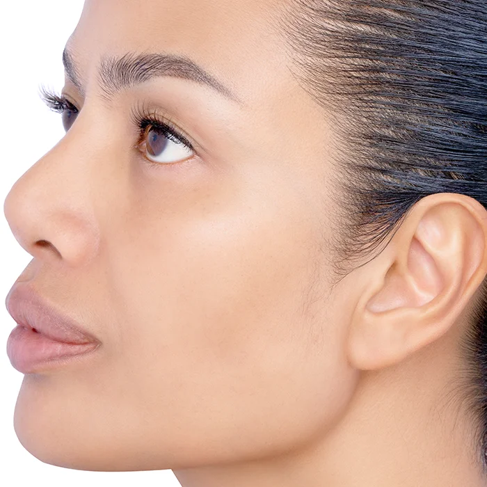 Pigmentation Treatment