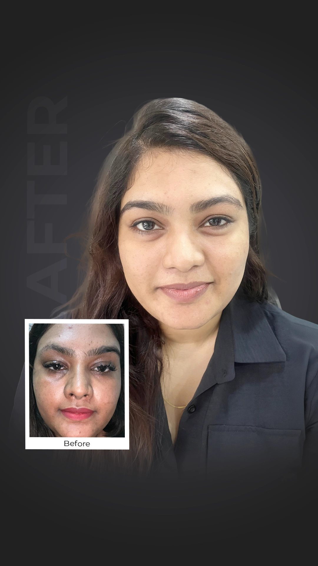 Skin result DNCC